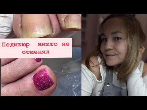 Видео: Педикюр / Обработка пальцев/ покрываем тонко гель лаком #педикюр 