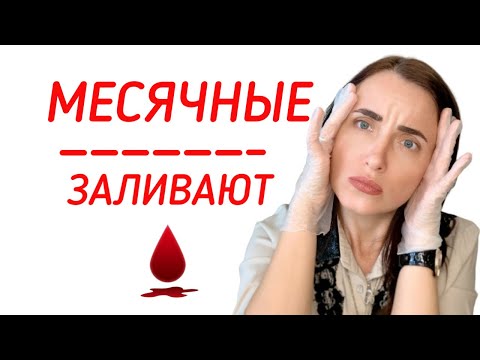 Видео: ОБИЛЬНЫЕ МЕСЯЧНЫЕ | КАК УМЕНЬШИТЬ МЕСЯЧНЫЕ