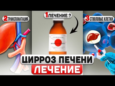 Видео: ЦИРРОЗ ПЕЧЕНИ: виды цирроза, современные методы лечения, стоимость лечения, прогноз жизни.