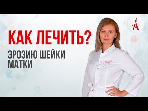 Видео: КАК ЛЕЧИТЬ ЭРОЗИЮ ШЕЙКИ МАТКИ?