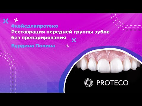 Видео: Реставрация композитами Tokuyama от Полины Бурдиной #proteco #реставрациязубов #кейсдляпротеко