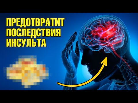 Видео: Восстановление после инсульта. Это точно поможет👍