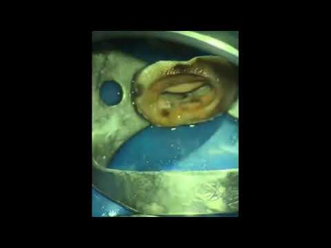 Видео: 2020-12-01 Новый файл для перелечивания