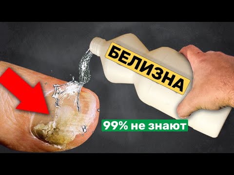 Видео: 99% не знают что Творит Белизна!