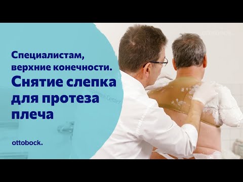 Видео: Снятие слепка при изготовлении протеза плеча. Для специалистов по протезированию рук