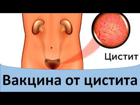 Видео: Вакцина от цистита