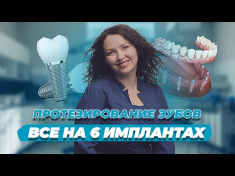 Видео: Нет зубов? Все зубы разрушены? Все об имплантации "ВСЕ НА 6". Стоматология Вариант в Самаре