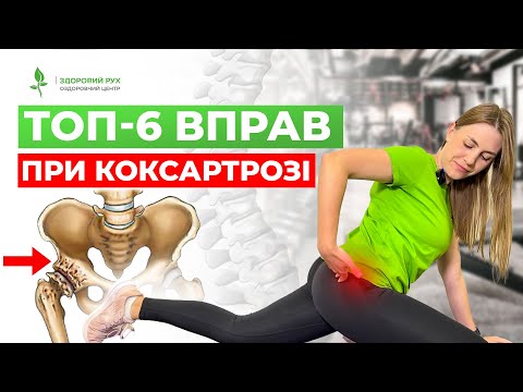 Видео: Комплекс вправ ВІД КОКСАРТРОЗУ та болю в кульшовому суглобі | Кінезітерапія