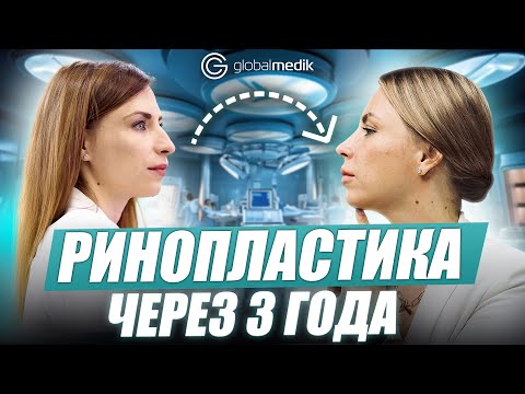 Видео: Ринопластика в Турции: честный отзыв спустя 3 года – пошла ли я бы на это снова?