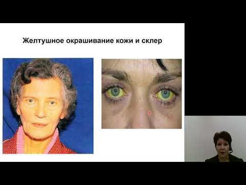 Видео: Фак. терапия (Внутренние болезни). Гепатиты, цирроз печени