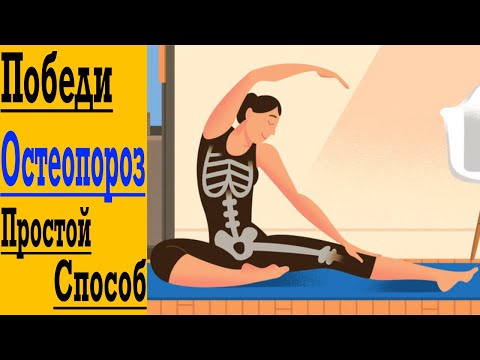 Видео: Победим Остеопороз и Боль в Суставах и Костях !