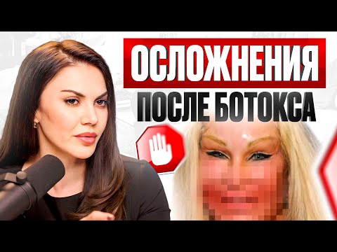 Видео: ЧТО МОЖЕТ ПОЙТИ НЕ ТАК? Осложнения после ботокса и филлеров