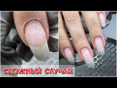 Видео: Коррекция ногтей на верхние формы / Градиент / Как рисовать градиент? Маникюр для начинающих #nails