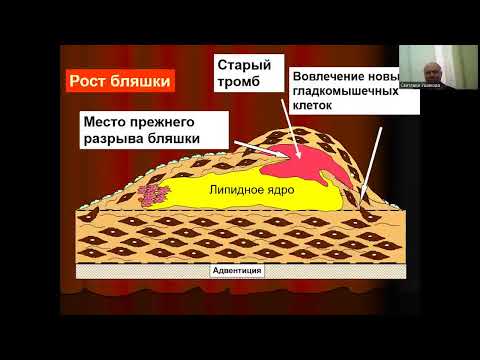 Видео: Поликлиническое дело. Диагностика стенокардии в поликлинике