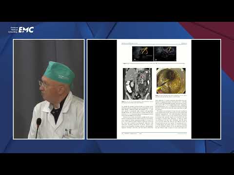 Видео: 13 Тактика хирурга при острой кишечной непроходимости - Прудков М. И.