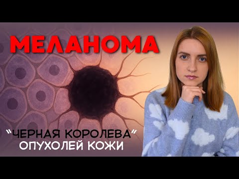 Видео: МЕЛАНОМА - ПРИЧИНЫ, СИМПТОМЫ, ВИДЫ, СТАДИИ, ДИАГНОСТИКА и ЛЕЧЕНИЕ #меднавигатор #онкология #рак