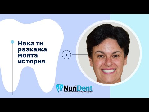 Видео: Екстракция на всички зъби и незабавно незабавно поставяне на зъбни импланти