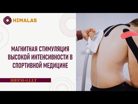 Видео: Ритмическая магнитная стимуляция высокой интенсивности в спортивной медицине