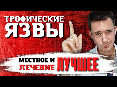 Видео: Трофическая язва | Местное лечение | Лучшее лечение