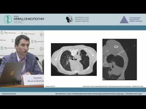 Видео: Трансторакальная биопсия легких