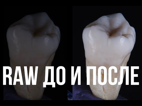 Видео: RAW файлы и их обработку   дентальная фотография