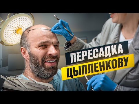 Видео: ПЕРЕСАДКА ВОЛОС ДЕНИСУ ЦЫПЛЕНКОВУ