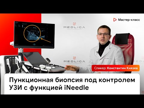 Видео: Пункционная биопсия под контролем УЗИ с функцией iNeedle