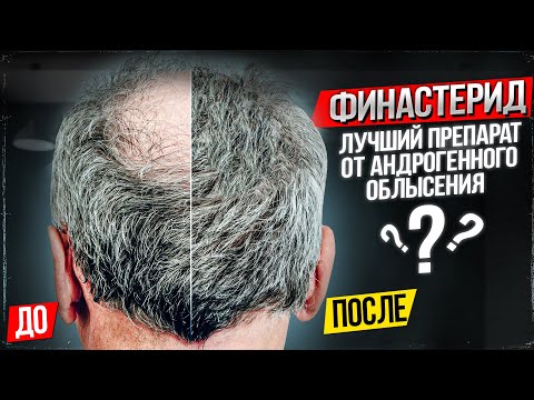 Видео: Финастерид - лучший препарат от андрогенного облысения (алопеции)?