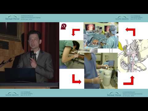 Видео: Нерешенные вопросы хирургии рака желудка