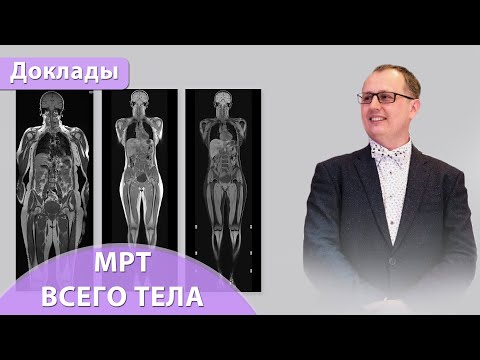 Видео: МРТ всего тела (Whole-body). Андрей Мангов