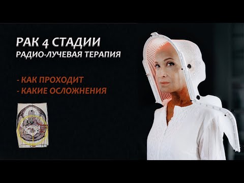 Видео: Рак 4 стадии. Моя история онкологии. Про радио-лучевую терапию. Серия 14