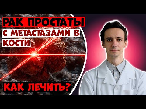 Видео: Метастазы рака простаты в кости: современные методы лечения.