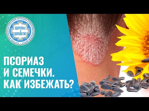 Видео: 🌻  Псориаз и семечки. Как избежать?