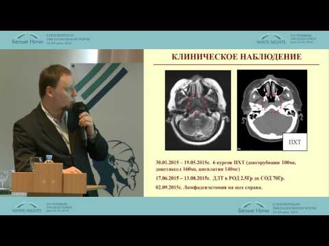 Видео: Современные тенденции в лечении рака носоглотки