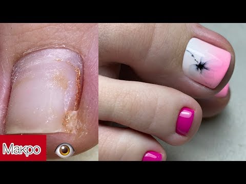 Видео: МАКРО ПЕДИКЮР. Полный педикюр и покрытие гель лаком. Цветок из вуали.