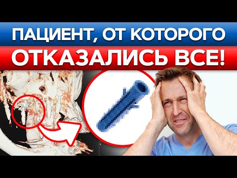 Видео: Самый жуткий случай стоматолога! Имплант пробил ПАЗУХУ НОСА! Как спасли пациентку?