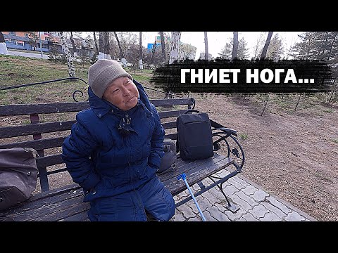 Видео: СГНИЛА НОГА СПАСАЯ МУЖА. Бездомная женщина. помощь людям.