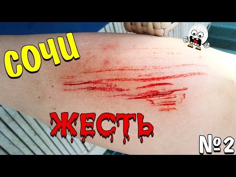 Видео: УЖАСЫ СОЧИ! У спасателей нет аптечки! Отдых на Чёрном Море