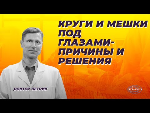 Видео: Круги и мешки под глазами. Причины и решения.