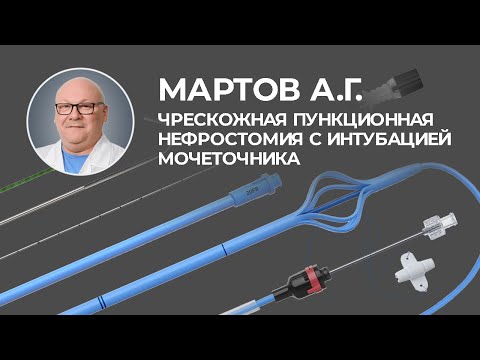 Видео: Чрескожная пункционная нефростомия с интубацией мочеточника. Отзыв Мартова Алексея Георгиевича.