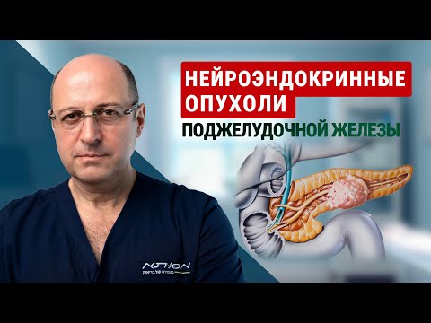 Видео: Нейроэндокринные опухоли поджелудочной железы: гормоны, диагностика и лечение | доктор Юрий Гольдес