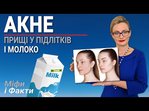 Видео: Акне прищі, чорні крапки на обличчі, спині – лікування в домашніх умовах. Причини акне у підлітків?