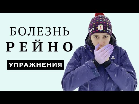 Видео: МЕРЗНУТ РУКИ / СИНДРОМ БОЛЕЗНЬ РЕЙНО / ЛФК УПРАЖНЕНИЯ ДЛЯ ПАЛЬЦЕВ РУК
