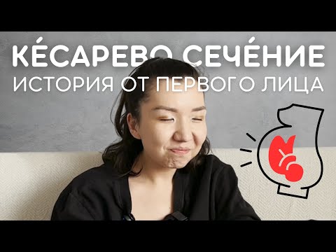 Видео: МОИ РОДЫ. ПЛАНОВОЕ КЕСАРЕВО СЕЧЕНИЕ. полный рассказ.
