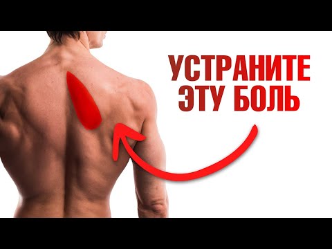 Видео: Болит ромбовидная мышца? Как устранить боль под лопаткой?👌