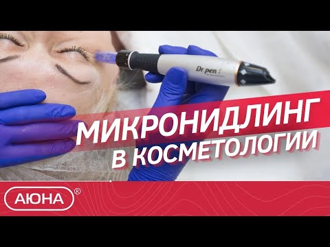 Видео: 🔥 МИКРОНИДЛИНГ в косметологии