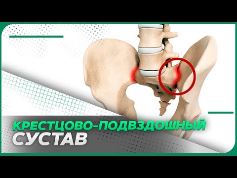 Видео: КПС или главная причина боли в пояснице?