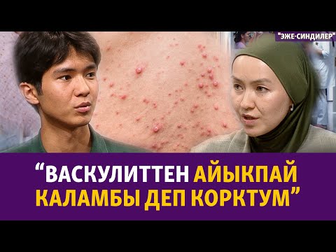 Видео: Туура эмес тамактануу жана сасык тумоо васкулитке алып келет | "Эже-сиңдилер"