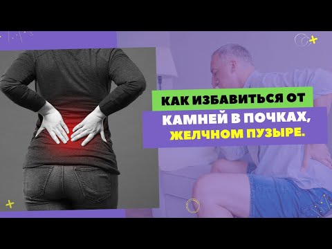 Видео: КАК ИЗБАВИТЬСЯ ОТ КАМНЕЙ В ЖЕЛЧНОМ ПУЗЫРЕ. ✅Отзыв пациента. [Шишова О.И.]