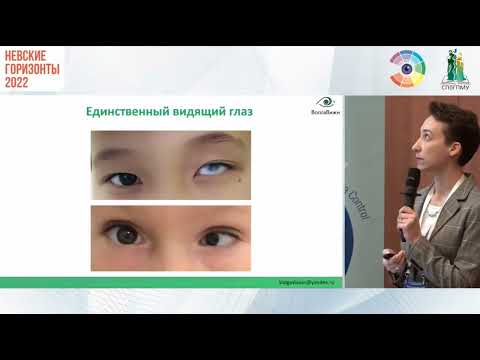 Видео: Когда следует отказаться от подбора ортолинз